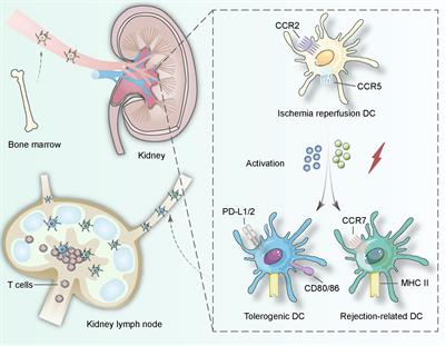 Dendritic Cells: Versatile Players in Renal Transplantation